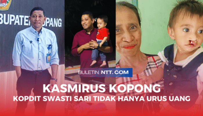 Kisah Para Orang Tua yang Menanti Operasi Sumbing Bibir Anak Mereka, yang Difasilitasi Kopdit Swasti Sari