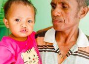 Swasti Sari Pastikan Persiapan Matang Operasi Sumbing Bibir di RSUD Naibonat